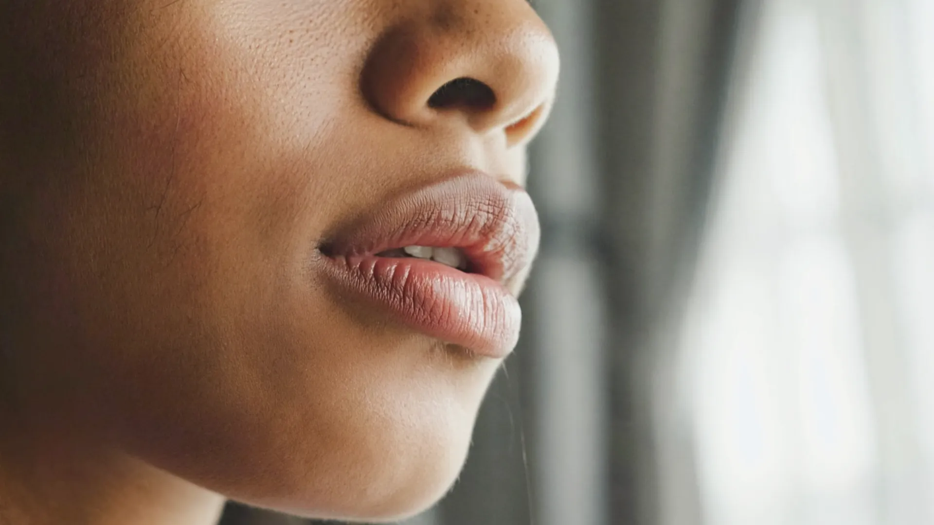 Natural, balanced lips after doctor-led lip filler
